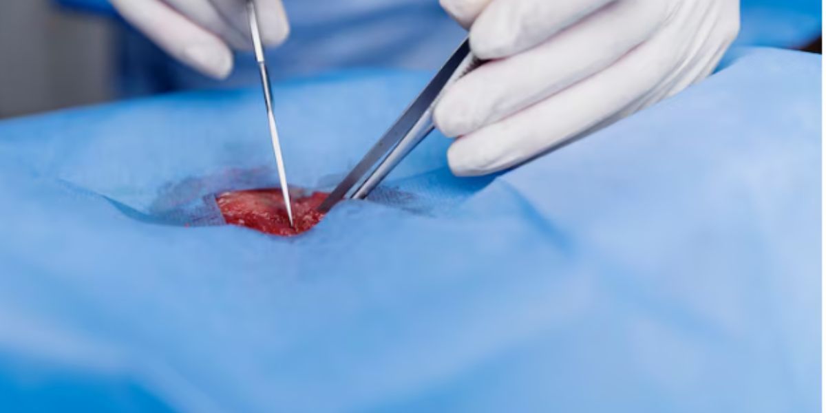 Circumcision Procedures