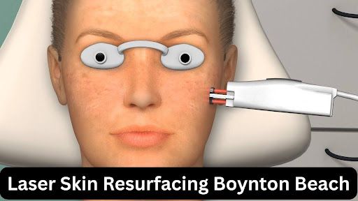 Laser Skin Resurfacing Boynton Beach - RejuvenationFL