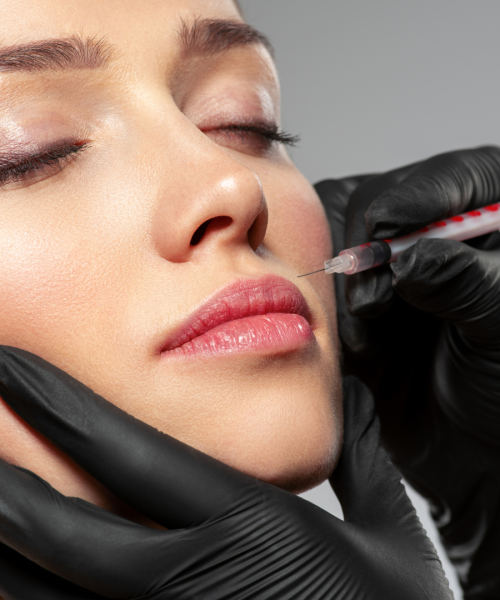 Dermal Filler Injections in Tampa | The Terra Wellness
